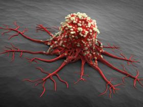 “循环肿瘤细胞”——开启肿瘤个体化治疗新时代