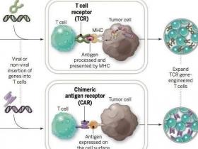 实体瘤CAR-T细胞治疗