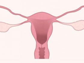晚期卵巢癌：放射治疗与免疫治疗联合