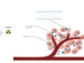 肺腺癌IV期的免疫整合治疗方式:CAP方案原理介绍与病例分享
