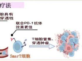 病例分享：晚期胃癌一线采用SmarT细胞联合治疗显著获益
