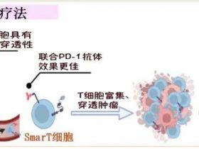 病例分享:晚期胃癌一线采用SmarT细胞联合治疗显著获益