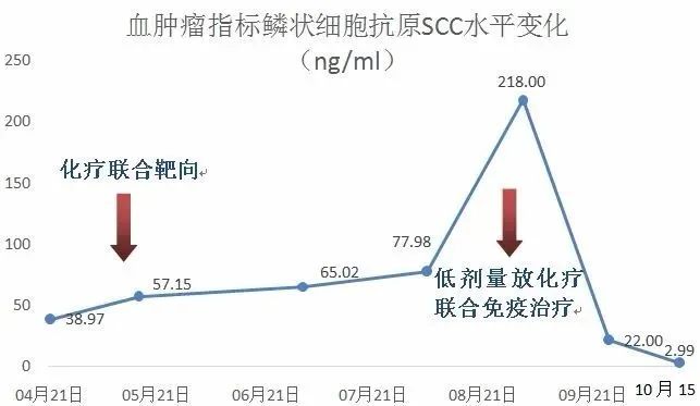 病例分享:新免疫整合治疗模式成功治疗转移性宫颈鳞癌 病例分享:新免疫整合治疗模式成功治疗转移性宫颈鳞癌
