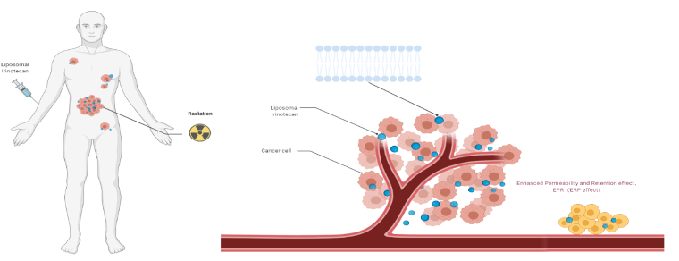 肺腺癌IV期的免疫整合治疗方式：CAP方案原理介绍与病例分享