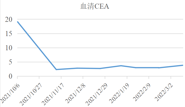 病例分享:局部给予PD-1抗体+VEGF抗体治疗一例伴心力衰竭晚期胃癌患者 病例分享:局部给予PD-1抗体+VEGF抗体治疗一例伴心力衰竭晚期胃癌患者