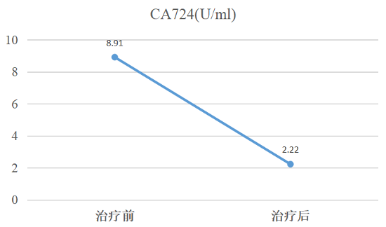 晚期胃癌一线治疗新技术：SmarT细胞联合治疗病例分享（晚期胃癌初治患者招募）