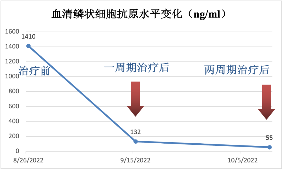 宫颈鳞癌放疗化疗免疫治疗后复发:新免疫模式获完全缓解 宫颈鳞癌放疗化疗免疫治疗后复发:新免疫模式获完全缓解